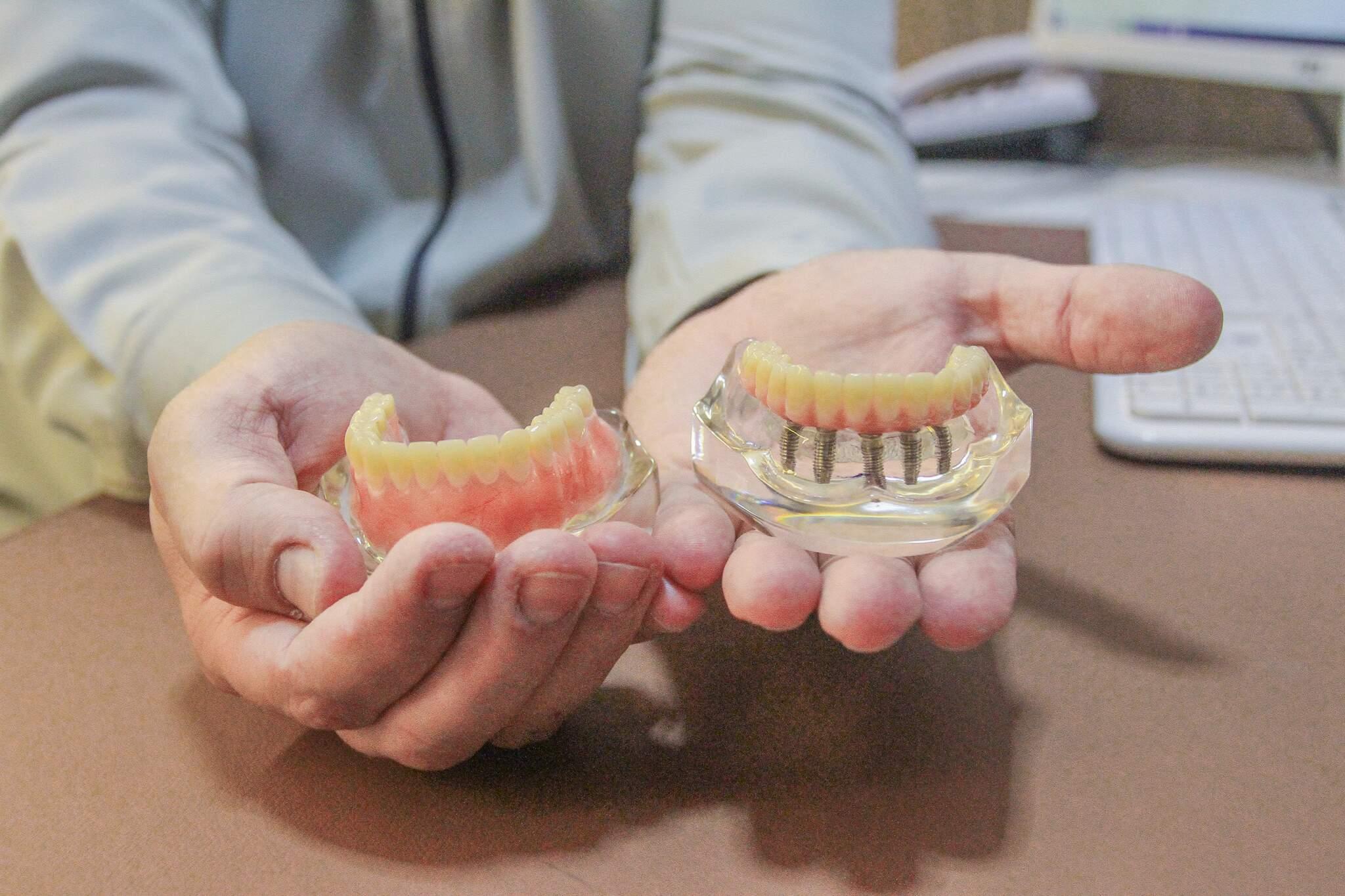 dentures vs dental implants